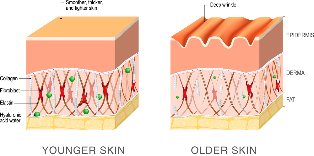 Diagram comparing younger skin with dense collagen, elastin and hyaluronic acid in the dermis to older skin with deep wrinkles and fewer fibers
