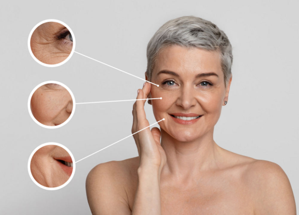 Smiling woman touching her face with close-up circles showing wrinkles around the eyes, cheeks and mouth
