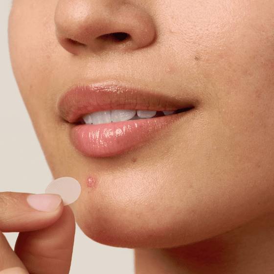 What Are Hydrocolloid Acne Patches and How Do They Work? Hero Cosmetics