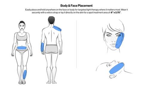 Spot treat and target areas on the body with the Celluma POD S2.