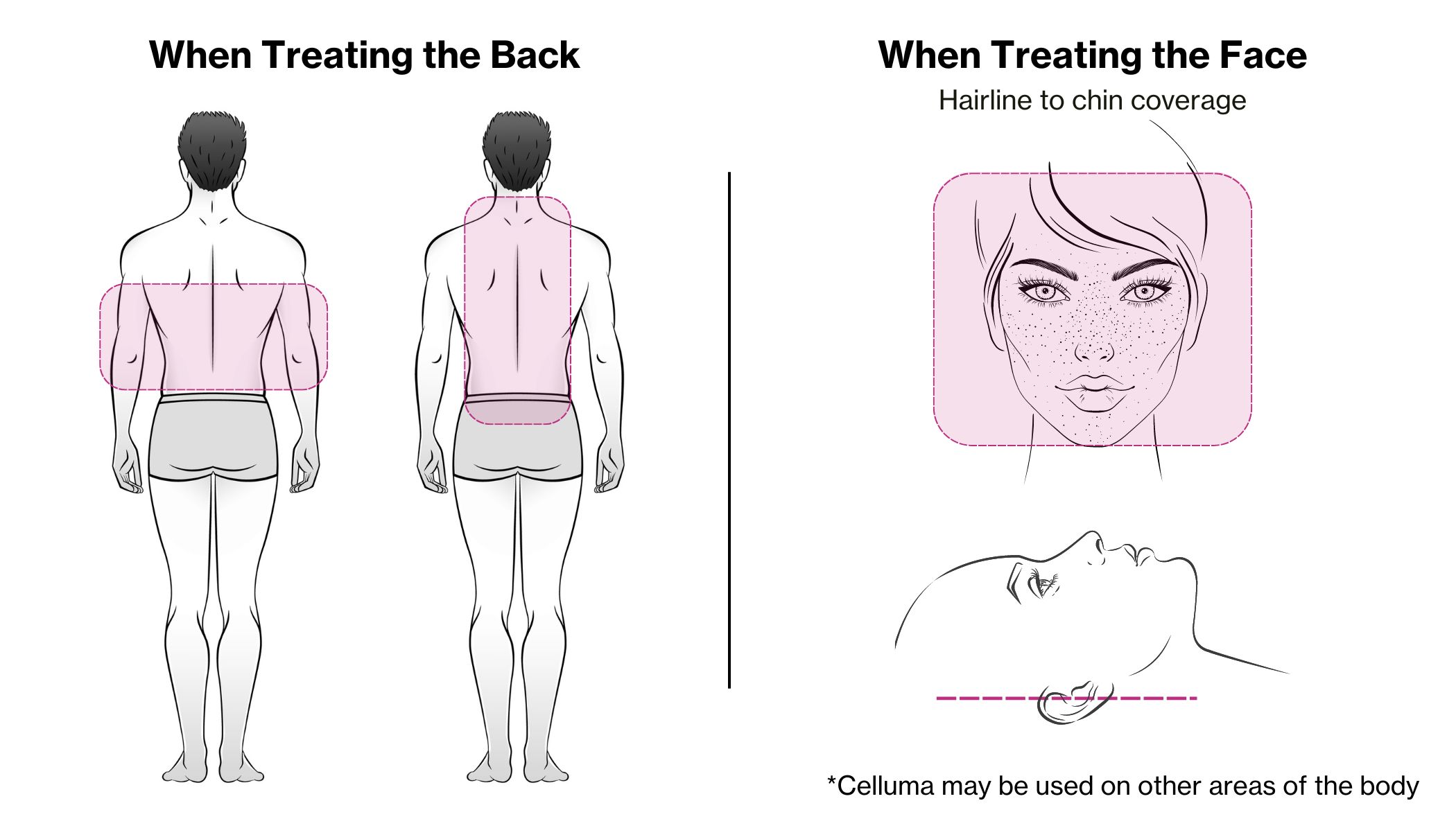 Celluma PRO | LED Light Therapy for Acne, Wrinkles and Pain Celluma PRO | LED Light Therapy for Acne, Wrinkles and Pain