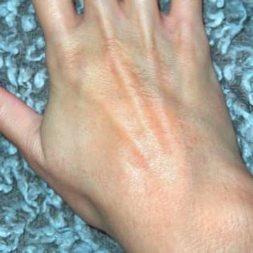 The back of a woman's hand clear of inflammation or eczema