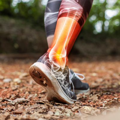 x ray style image of a runner's lower leg showing red inflammation to represent a sport related injury. the runner is wearing grey shoes and is standing on a leaf forest floor surrounded by trees