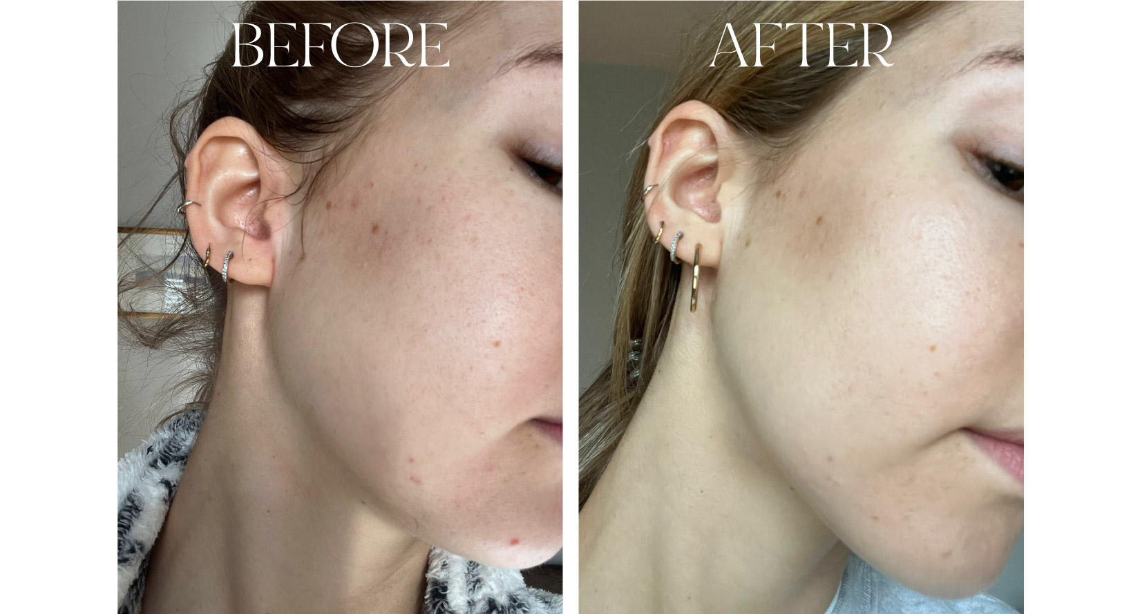 Cleanser Customer Before and After Image