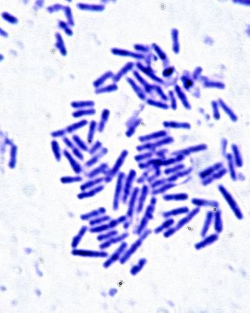 photo of b-subtilis 