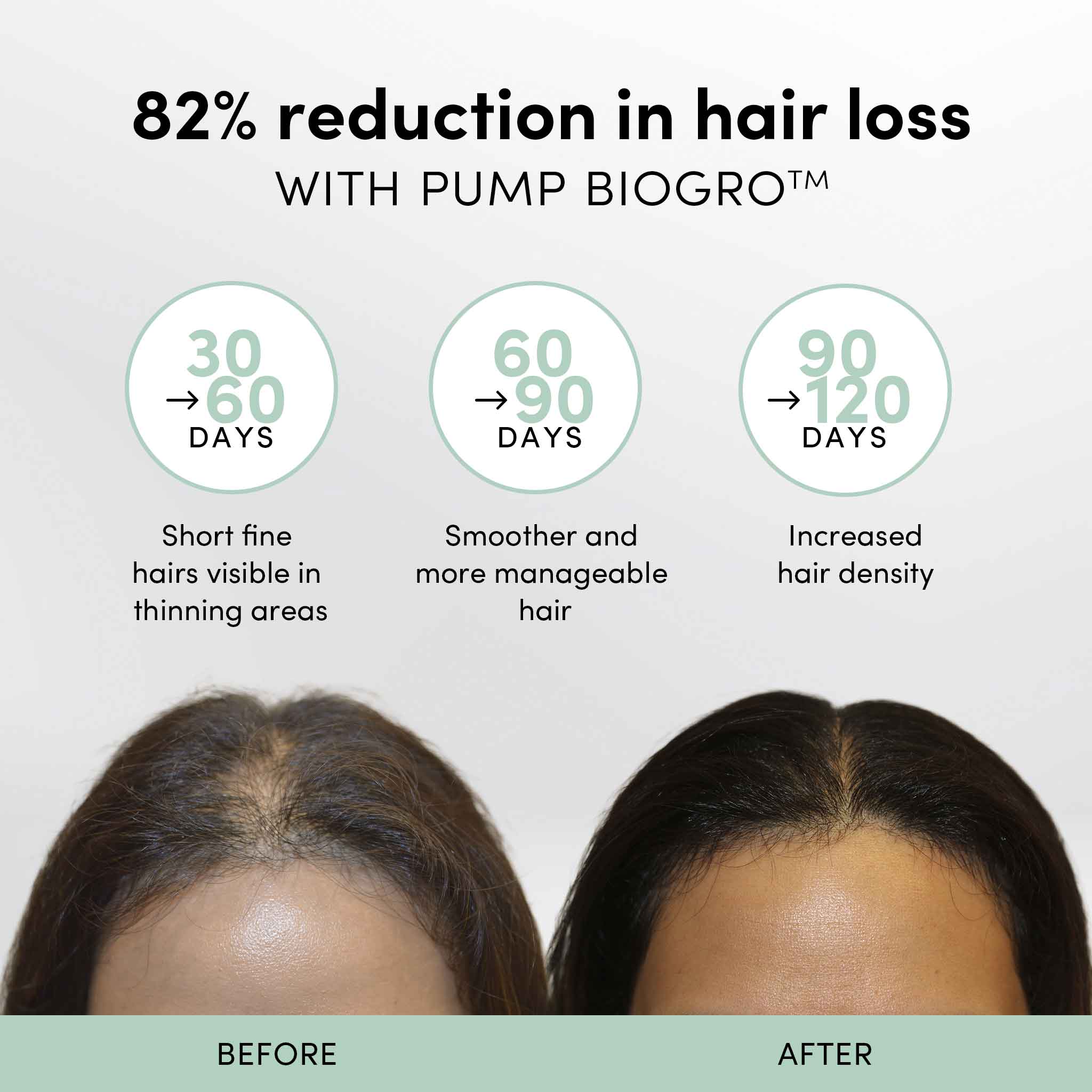 Biogro Hair Growth Serum Trio Pack