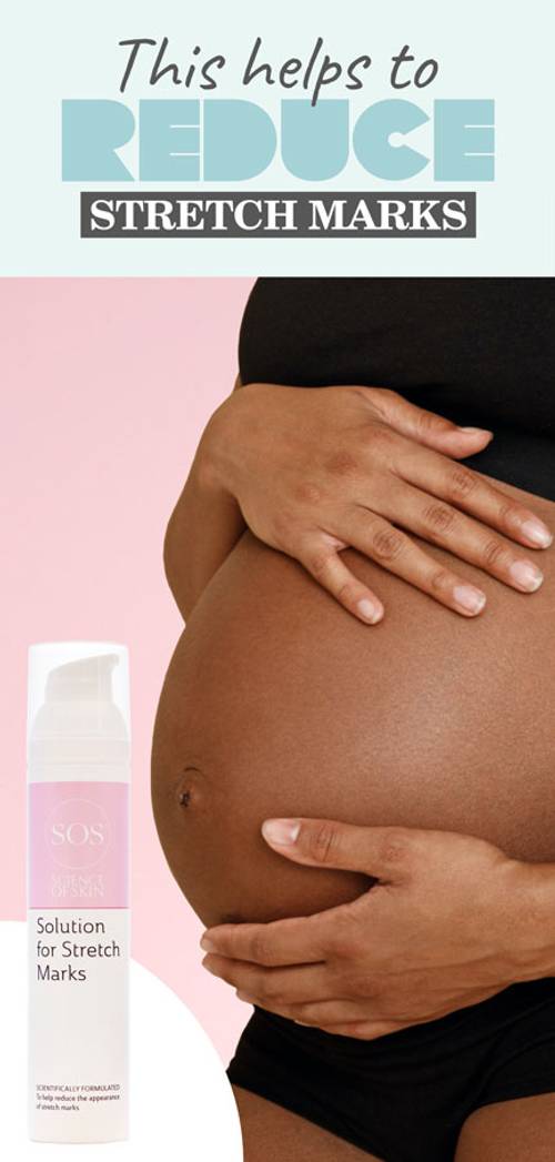 Solution for Stretch Marks