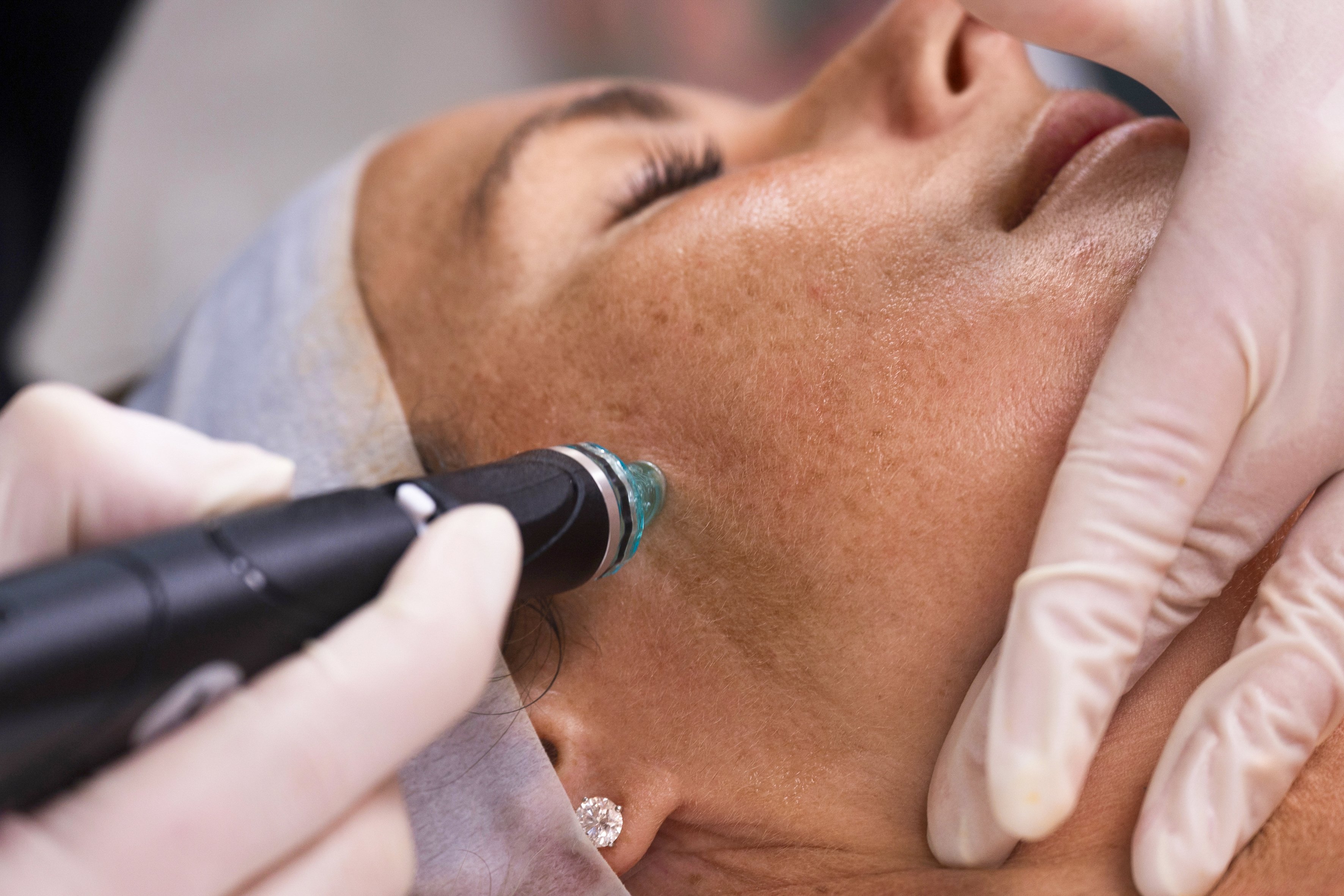 HydraFacial