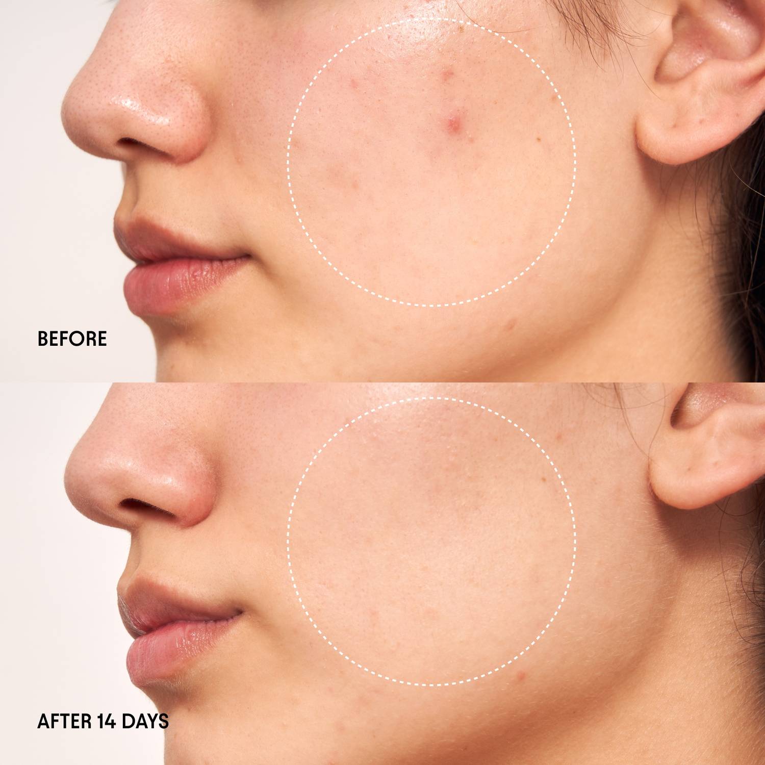 Before and after