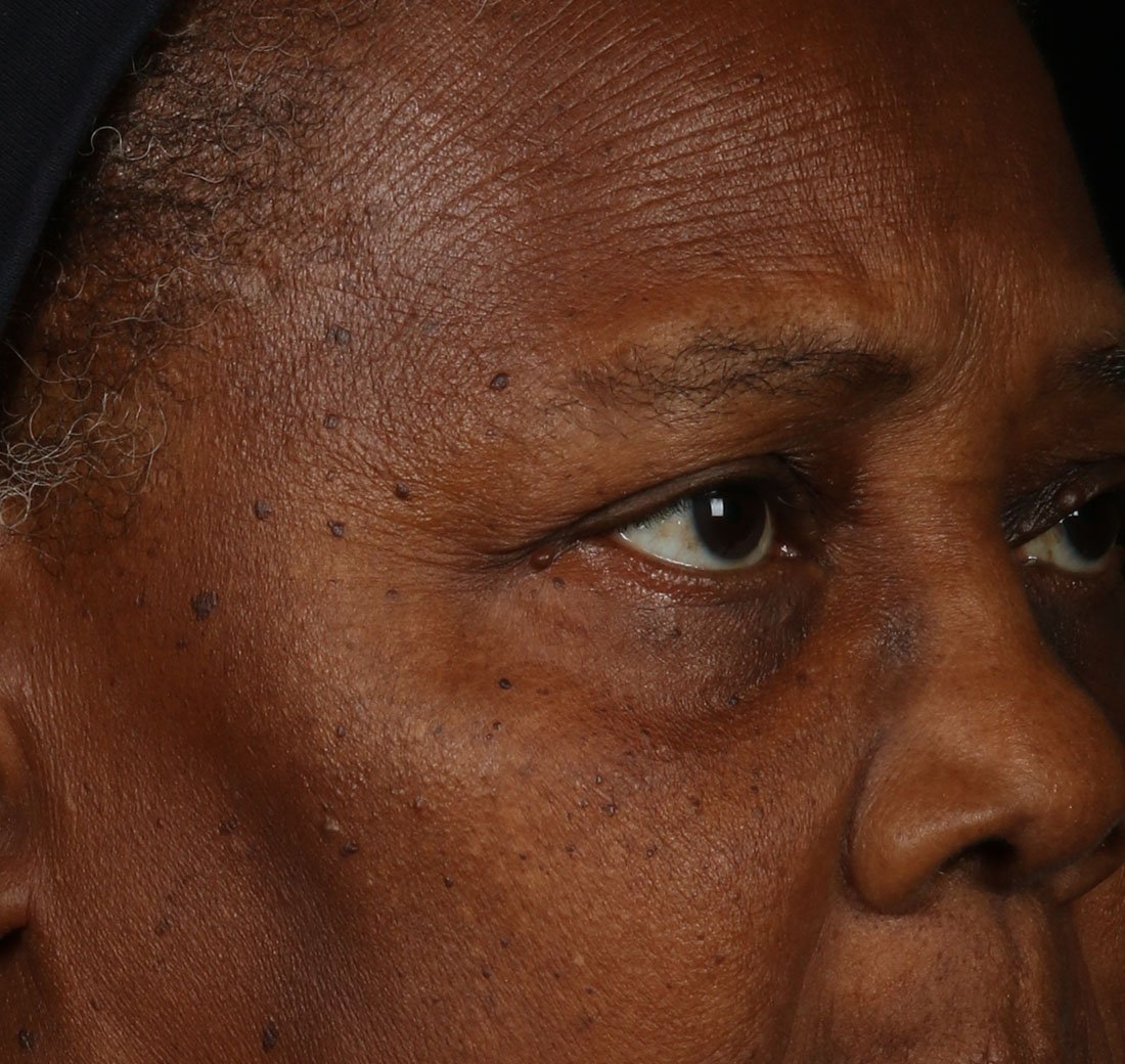 Close-up of facial skin before using Obagi ELASTIderm Facial Serum, showing visible signs of uneven texture.