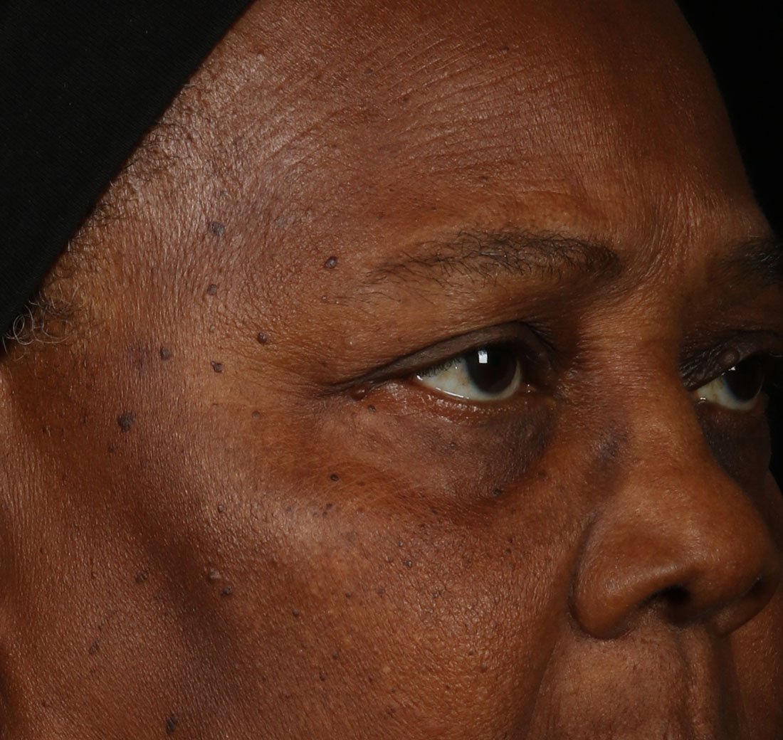 Close-up of facial skin after using Obagi ELASTIderm Facial Serum, appearing smoother and more even.
