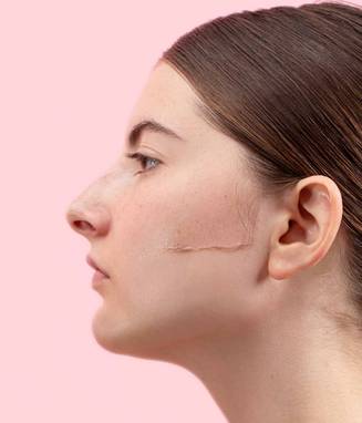 Nura - Sonic Dermaplaner