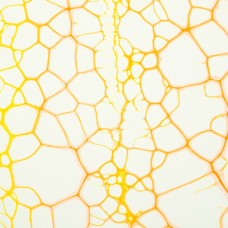 Yellow Cell Structure Painting