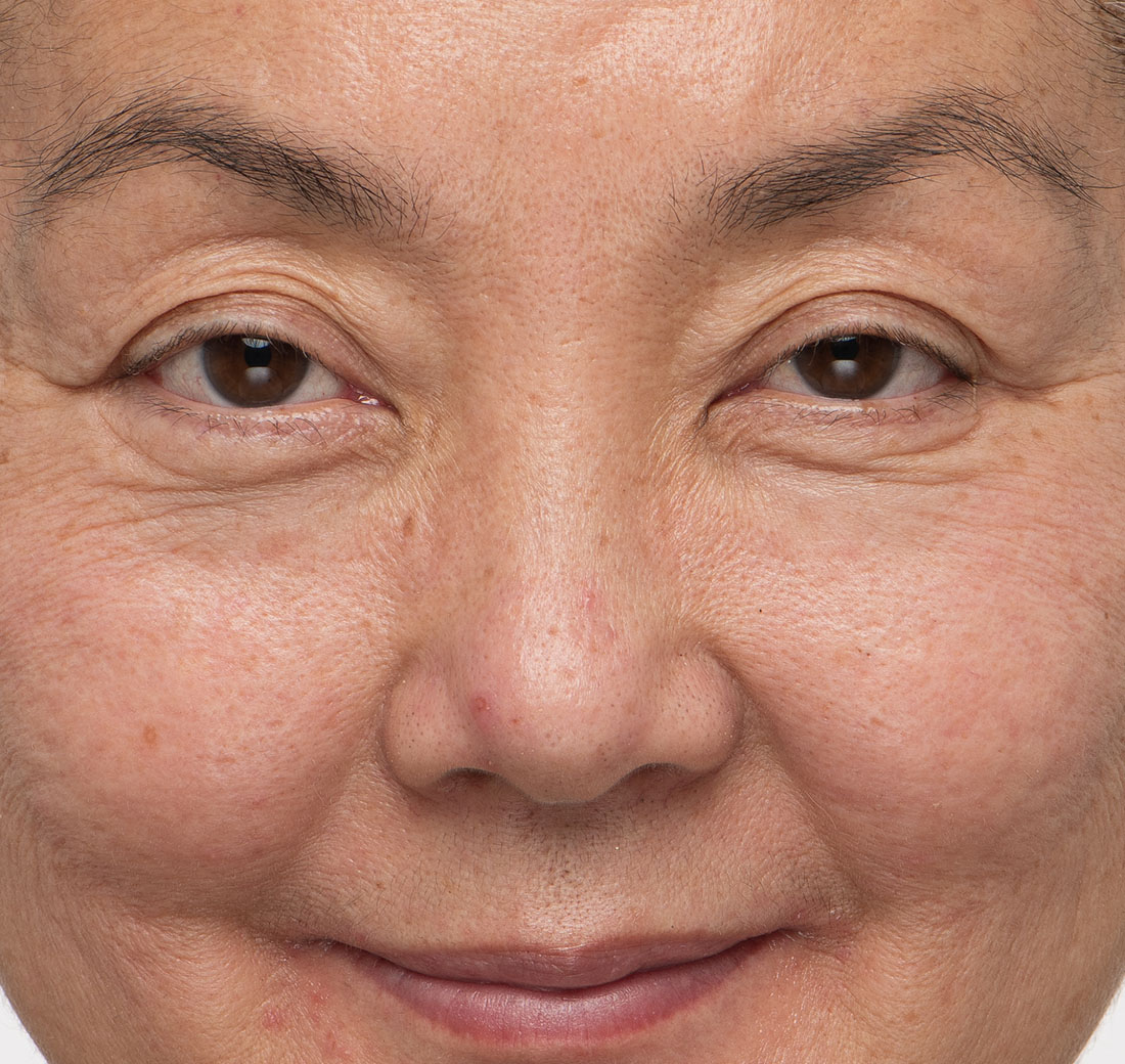 Close-up of eyebrows after using Obagi Nu-Cil Eyebrow Boosting Serum, looking fuller and more even.