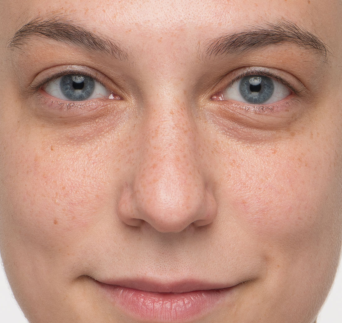 Close-up of eyebrows after using Obagi Nu-Cil Eyebrow Boosting Serum, with improved thickness.