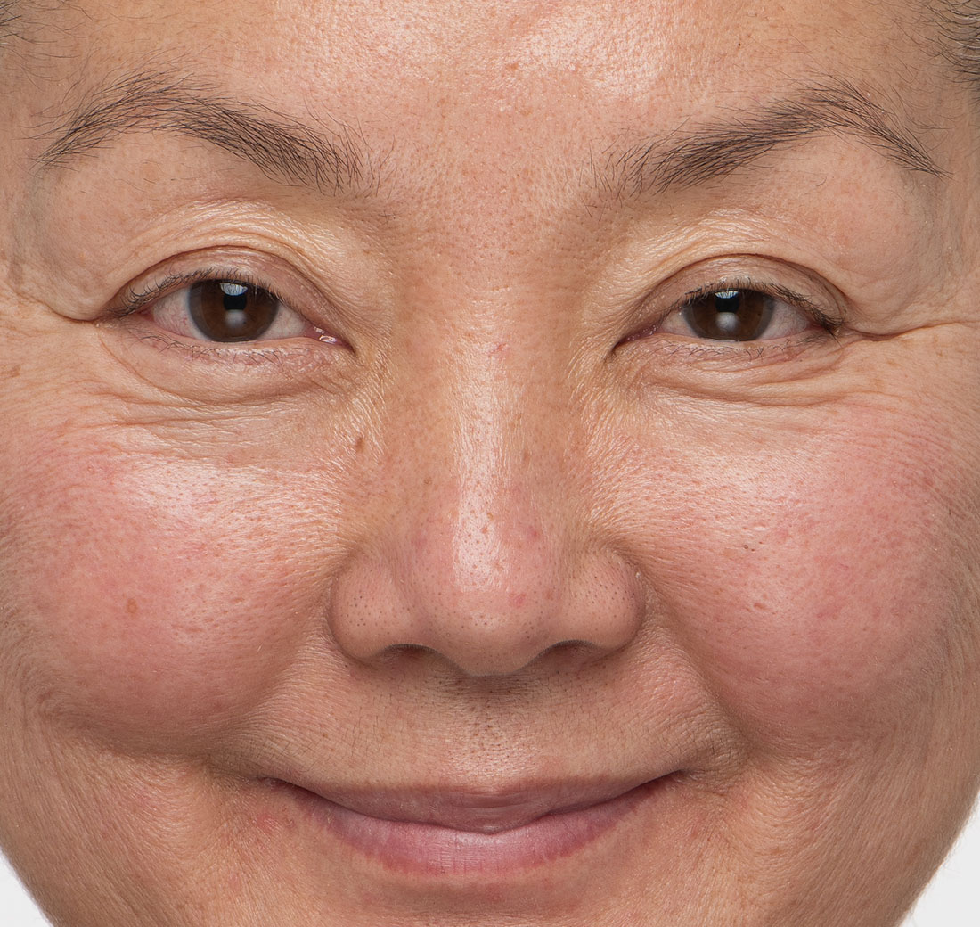 Close-up of eyebrows before using Obagi Nu-Cil Eyebrow Boosting Serum, showing sparse hair growth.