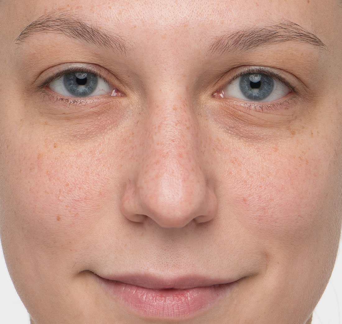 Close-up of eyebrows before using Obagi Nu-Cil Eyebrow Boosting Serum, appearing sparse.